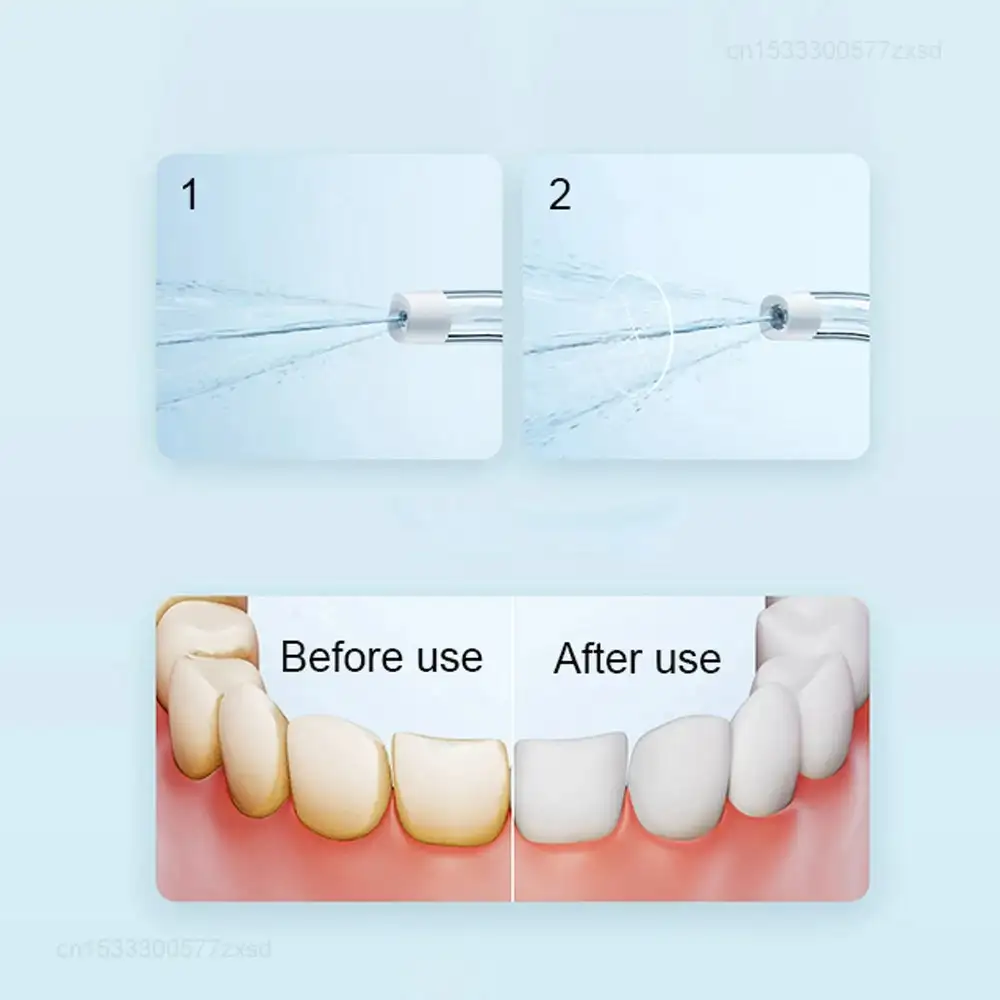 Xiaomi Mijia F300 Oral Irrigator